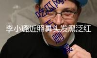 李小璐近照鼻頭發黑泛紅，43歲了還在尋求少女感，完全變成幼態臉 